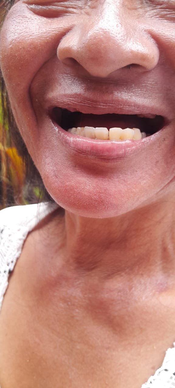 bali gigi tukang gigi dokter gigi bali reparasi gigi tambal gigi 13