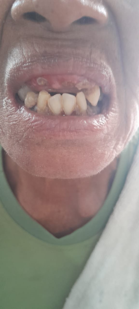 bali gigi tukang gigi dokter gigi bali reparasi gigi tambal gigi 15
