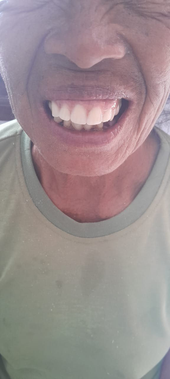 bali gigi tukang gigi dokter gigi bali reparasi gigi tambal gigi 19